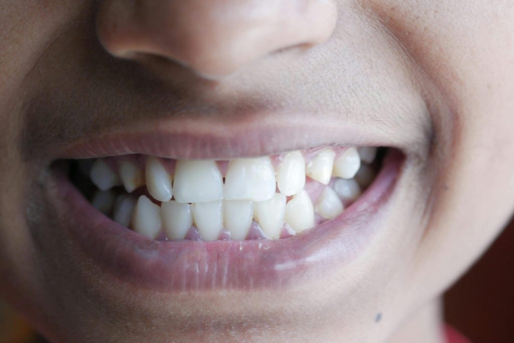 Close-up image of a person's smile highlighting teeth and lips, vibrant and cheerful.